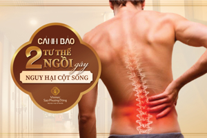 2 tư thế ngồi gây hại cột sống mà nhiều người vẫn vô tình mắc phải  