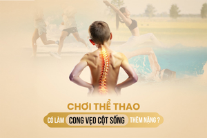 CHƠI THỂ THAO CÓ LÀM THÊM NẶNG CONG VẸO CỘT SỐNG ? 