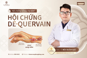 HỘI CHỨNG "CỔ TAY MẸ BỈM" - HỘI CHỨNG DE QUERVAIN