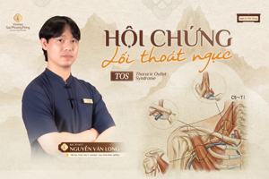 Hội chứng lối thoát ngực (TOS) – Nhận diện, chẩn đoán và hướng điều trị